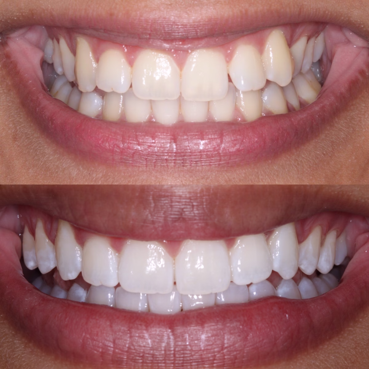 Georgetown Dentistry Smile Gallery 591ba9d5 12f3 41d6 b447 29d2c25edbac migrated - Smile Gallery Georgetown Dentistry Smile Gallery 591ba9d5 12f3 41d6 b447 29d2c25edbac migrated