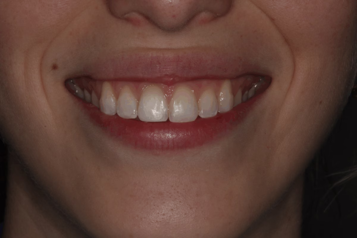Georgetown Dentistry Smile Gallery Georgetown Dentistry Smile Gallery after migrated - Smile Gallery Georgetown Dentistry Smile Gallery Georgetown Dentistry Smile Gallery after migrated