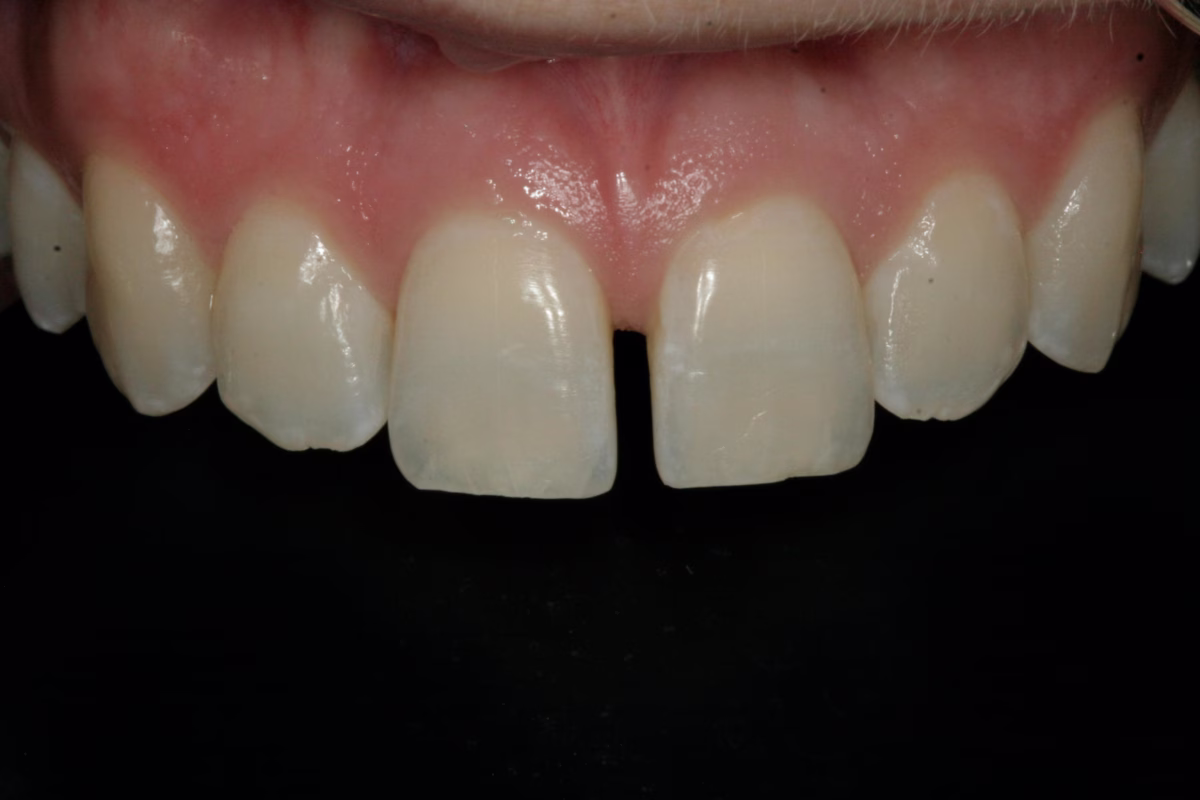 Georgetown Dentistry Smile Gallery Georgetown Dentistry Smile Gallery dentist washington dc smile 01 migrated - Smile Gallery Georgetown Dentistry Smile Gallery Georgetown Dentistry Smile Gallery dentist washington dc smile 01 migrated