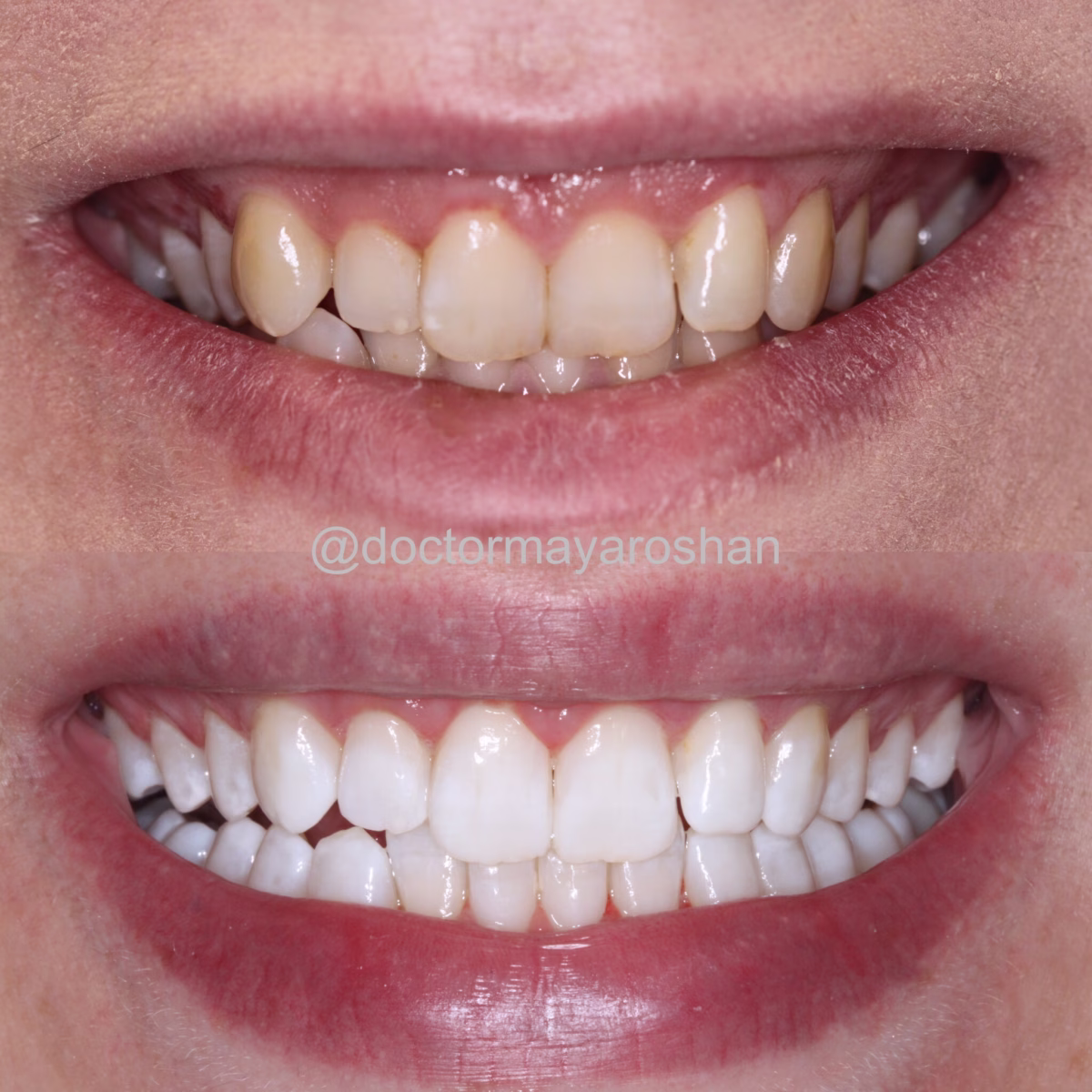 Georgetown Dentistry Smile Gallery img 0354 migrated - Smile Gallery Georgetown Dentistry Smile Gallery img 0354 migrated