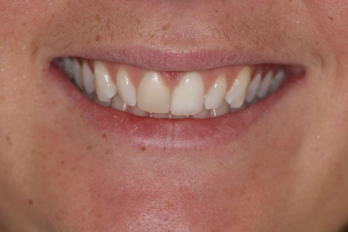 Georgetown Dentistry Smile Gallery img 1282 migrated - Smile Gallery Georgetown Dentistry Smile Gallery img 1282 migrated