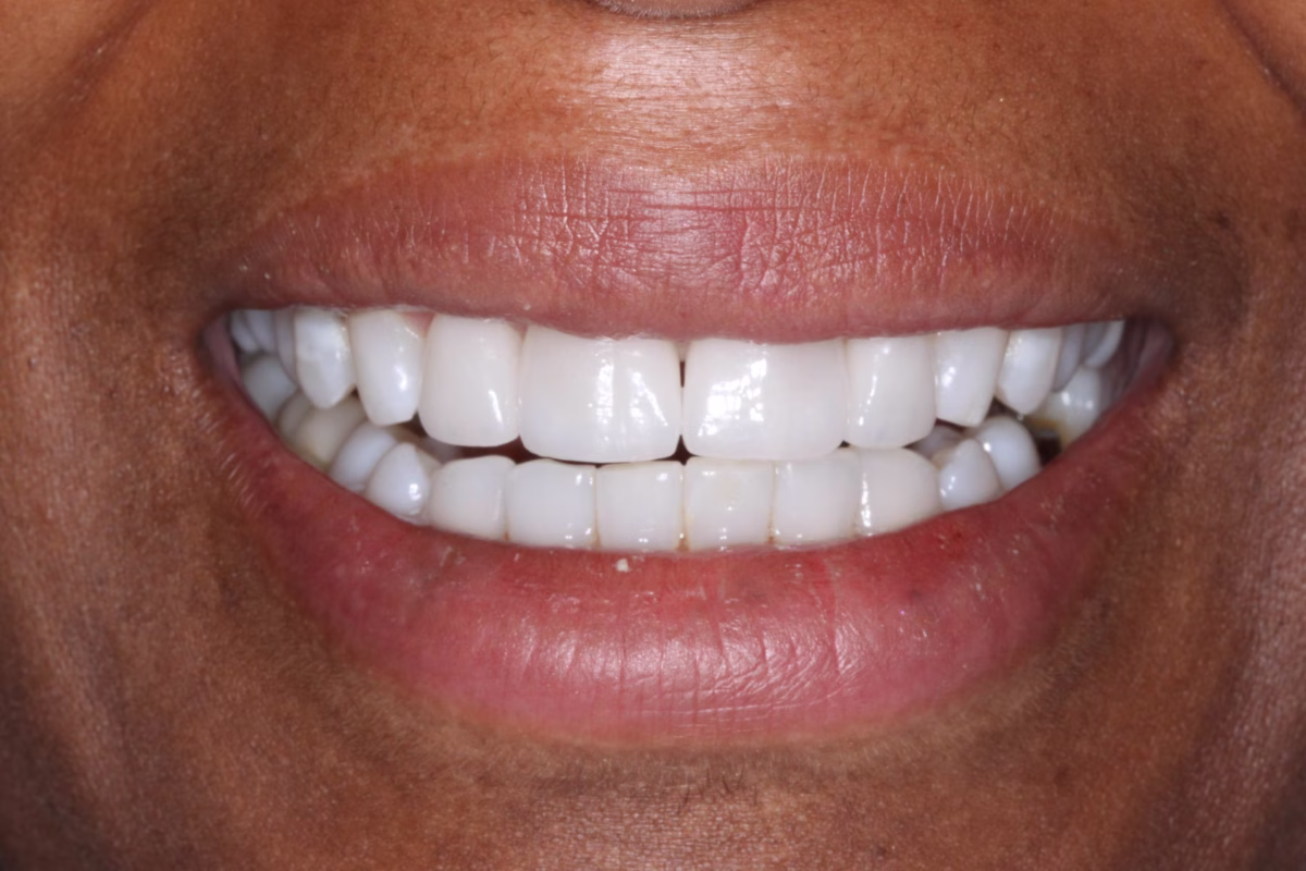 Georgetown Dentistry Smile Gallery img 3455 1 migrated - Smile Gallery Georgetown Dentistry Smile Gallery img 3455 1 migrated
