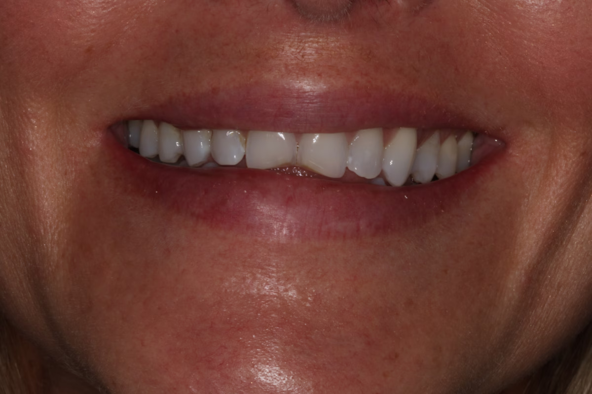 Georgetown Dentistry Smile Gallery img 9134 migrated - Smile Gallery Georgetown Dentistry Smile Gallery img 9134 migrated