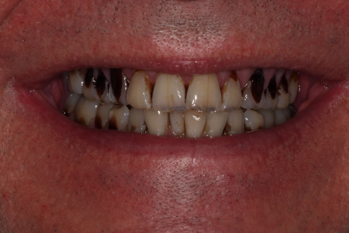 Georgetown Dentistry Smile Gallery img 9376 migrated - Smile Gallery Georgetown Dentistry Smile Gallery img 9376 migrated