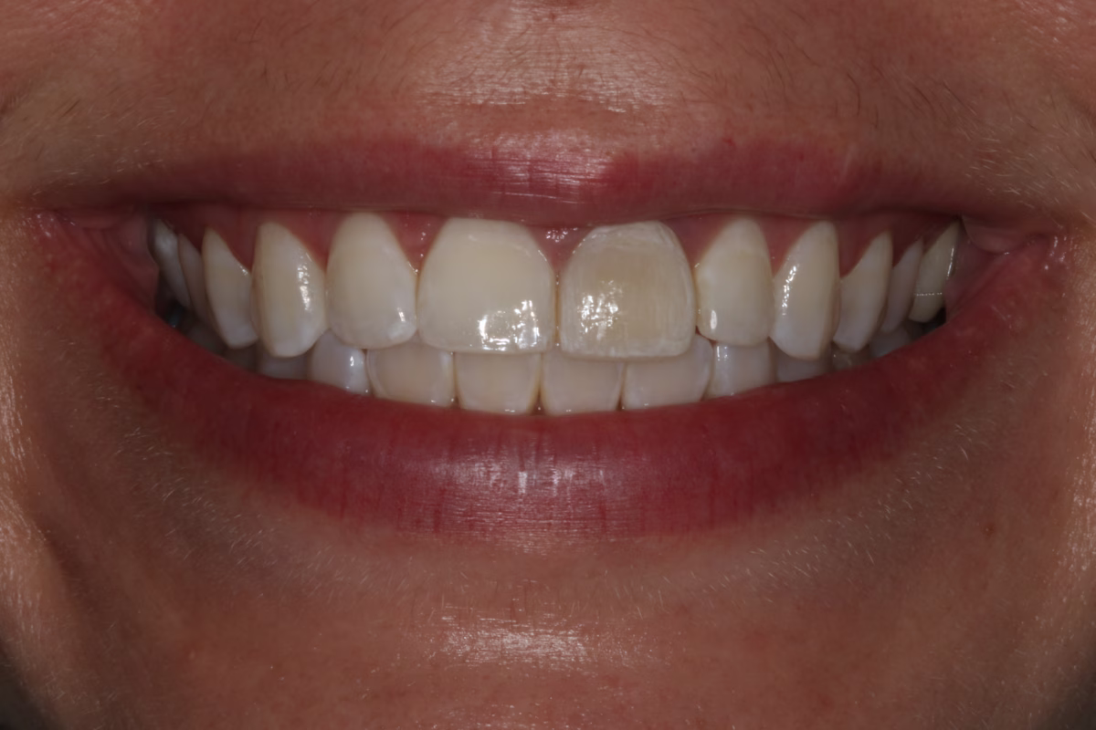 Georgetown Dentistry Smile Gallery img b4 migrated - Smile Gallery Georgetown Dentistry Smile Gallery img b4 migrated