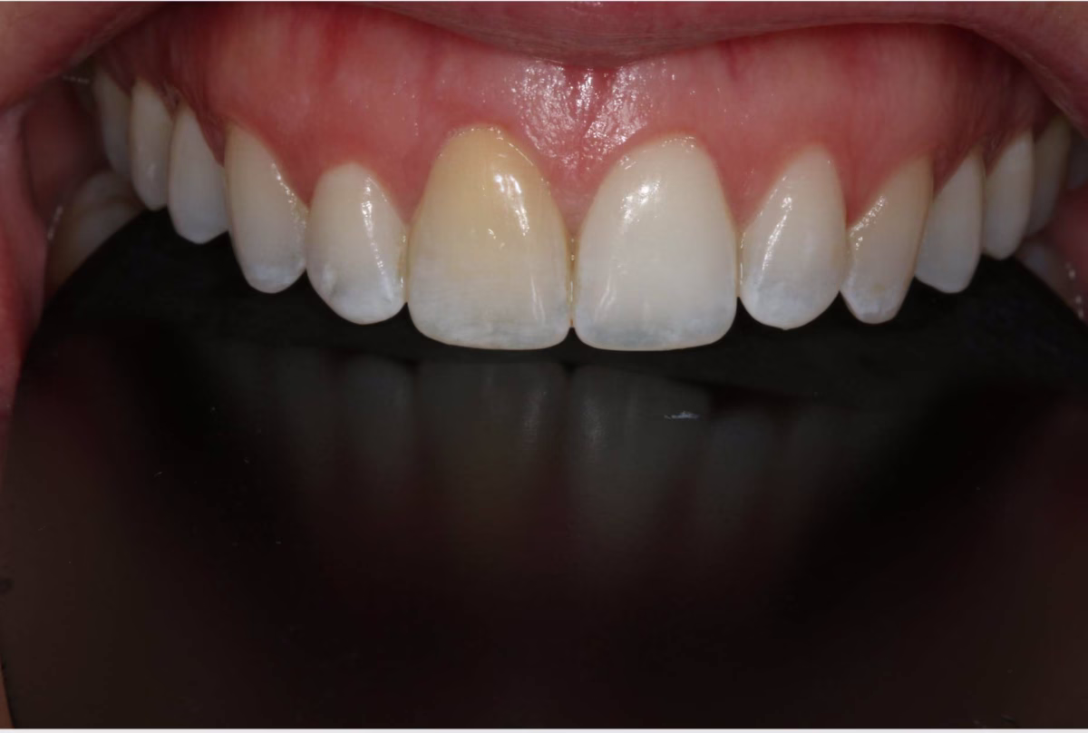 Georgetown Dentistry Smile Gallery screen shot 2022 08 30 at 10.30.42 am migrated - Smile Gallery Georgetown Dentistry Smile Gallery screen shot 2022 08 30 at 10.30.42 am migrated