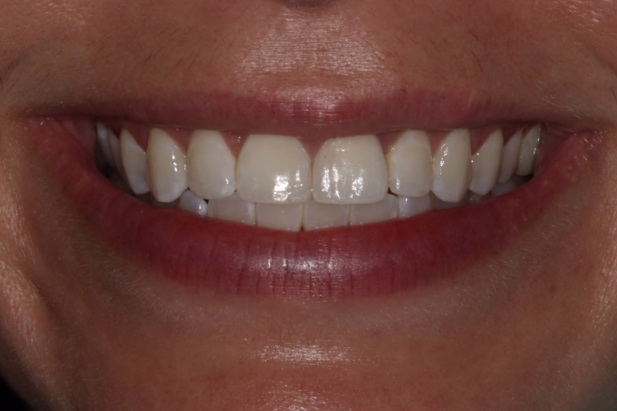 Georgetown Dentistry Smile Gallery single central veyezg7 migrated - Smile Gallery Georgetown Dentistry Smile Gallery single central veyezg7 migrated