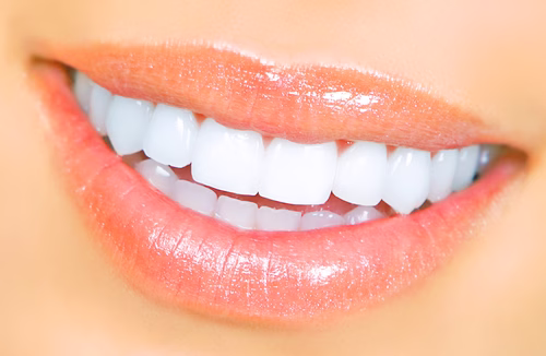 Get a Hollywood Smile with Dr. Kevin Sands