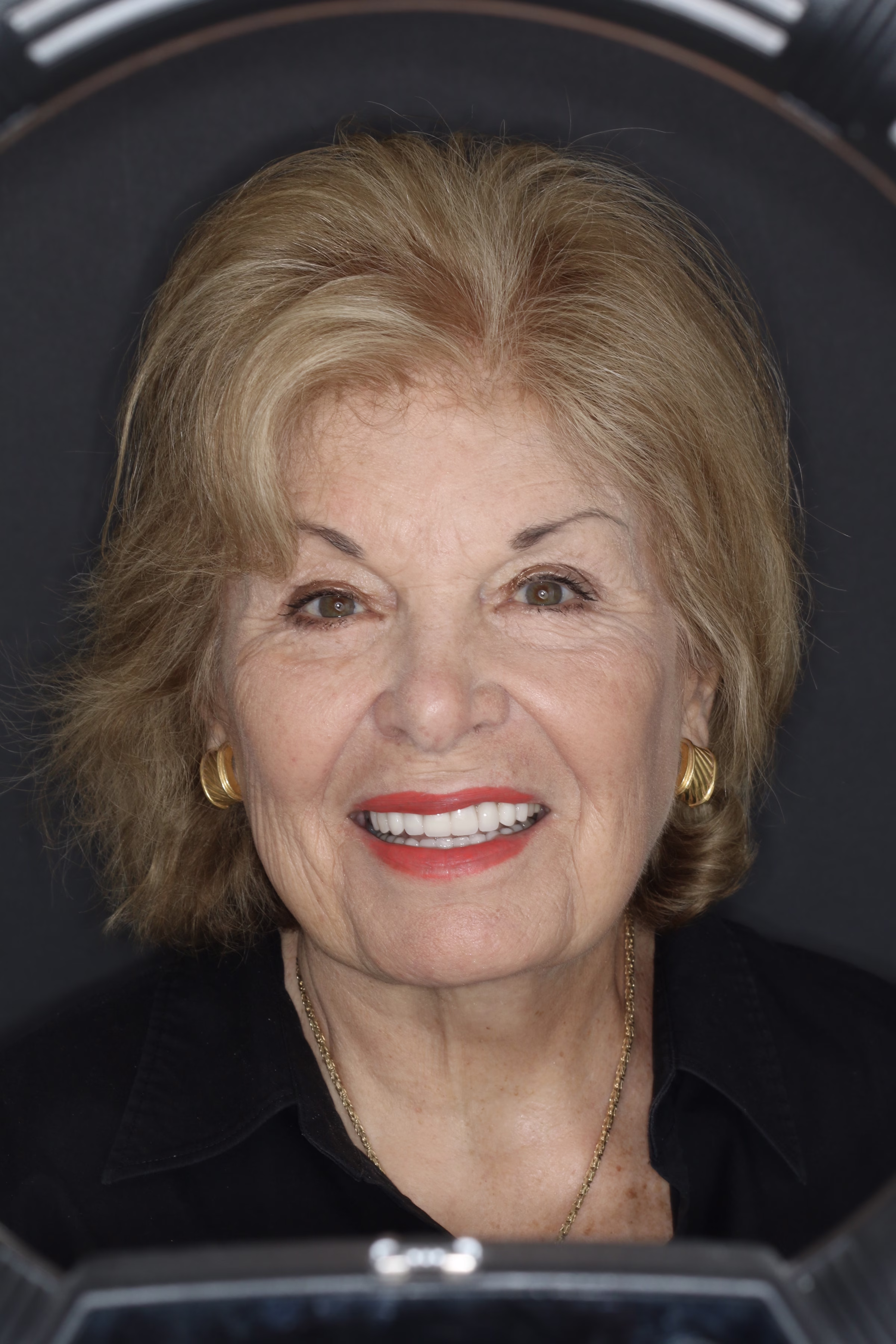 Washington DC cosmetic dentistry patient veneers and full mouth reconstruction headshot