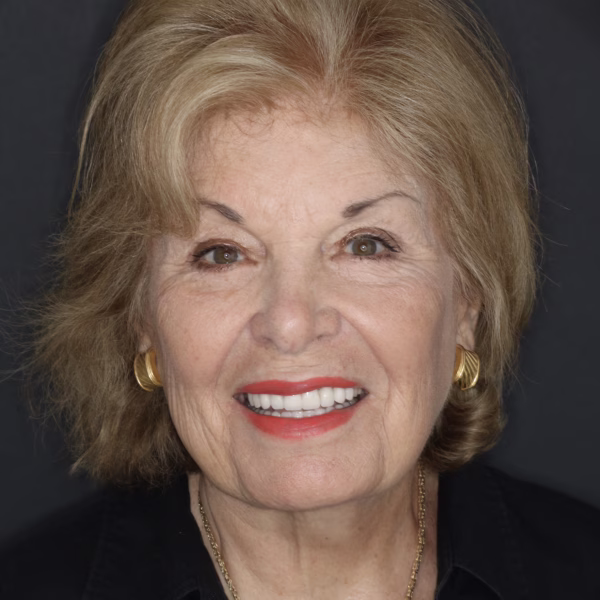 Washington DC cosmetic dentistry patient veneers and full mouth reconstruction headshot